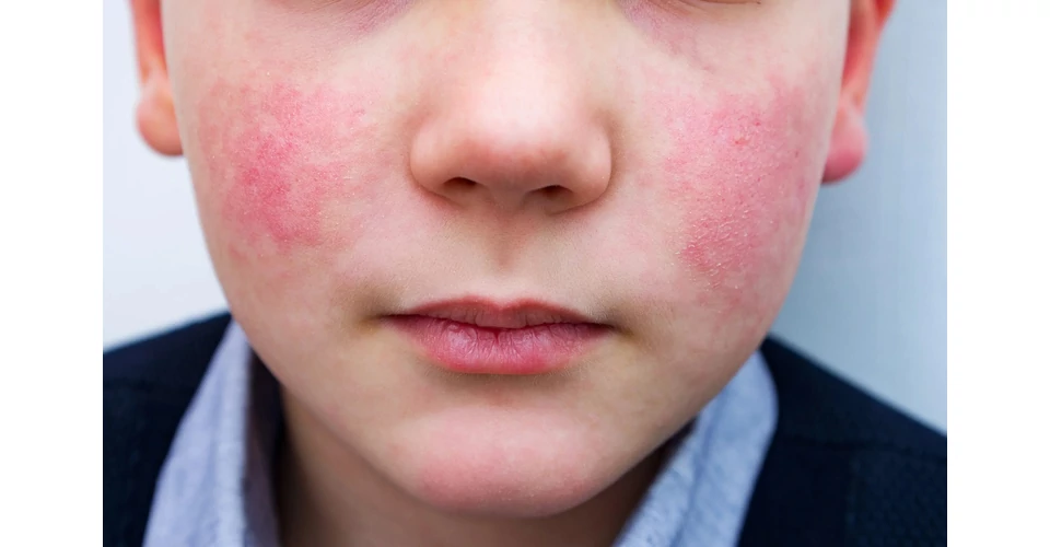 Amikor a bőr már nem kompenzál – mi áll a makacs bőrproblémák hátterében?